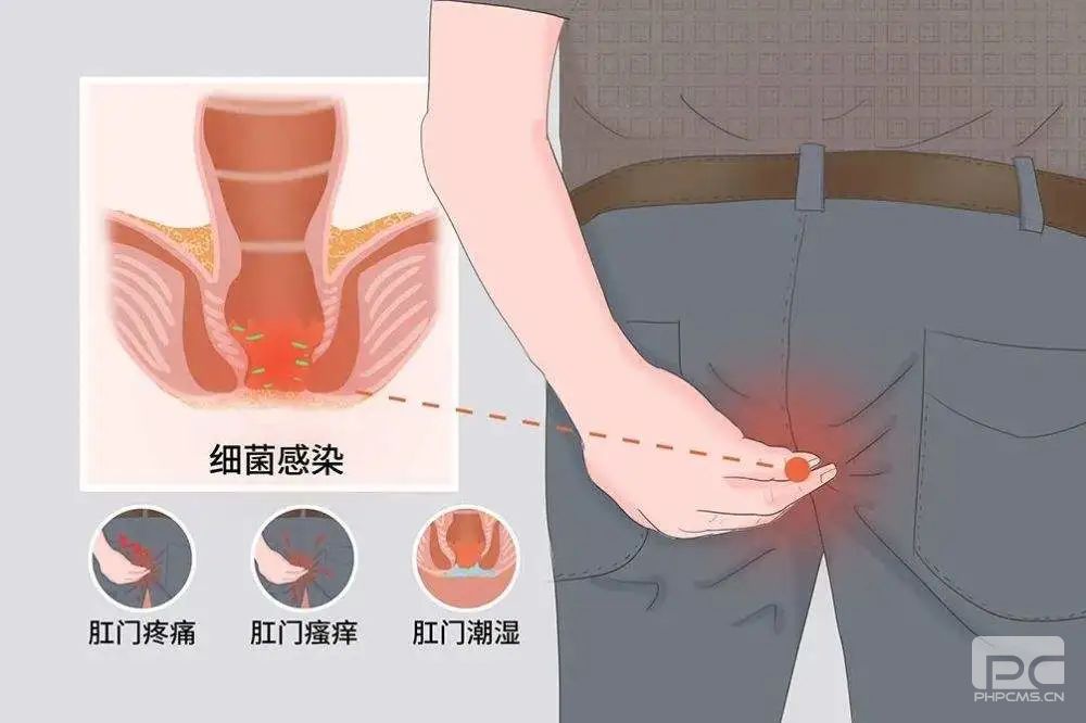 山西肛泰肛肠医院：陈旧性肛裂的危害有哪些