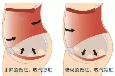 山西肛泰肛肠医院：直肠脱垂怎么回事，不治能自行恢复吗？
