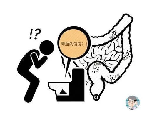 山西肛泰肛肠医院：便血的病因是什么？