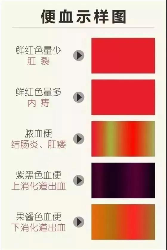 山西肛泰肛肠医院：注意便血不只是痔疮