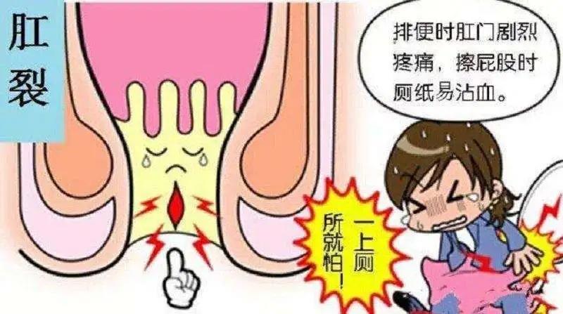 山西肛泰肛肠医院:肛门有裂口一直不好,反反复复怎么办?