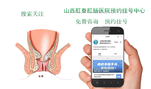 山西肛泰肛肠医院:肛裂一直不好,反反复复怎么办?
