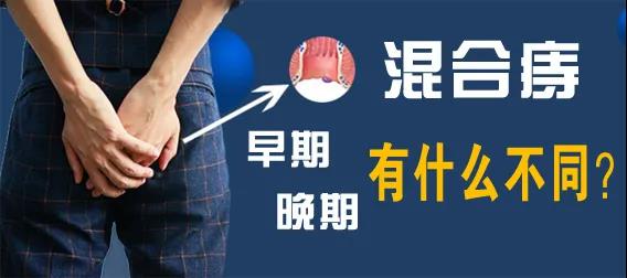 山西肛泰肛肠医院：混合痔早期和晚期有什么不同？